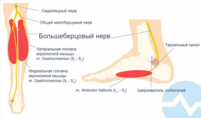 Что собой представляет болезнь малоберцового нерва?